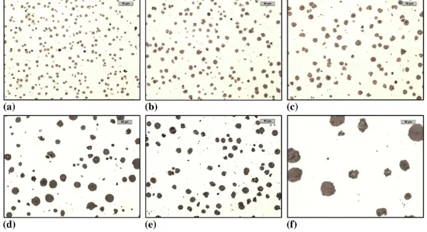 What Is the Microstructure of Ductile Iron?
